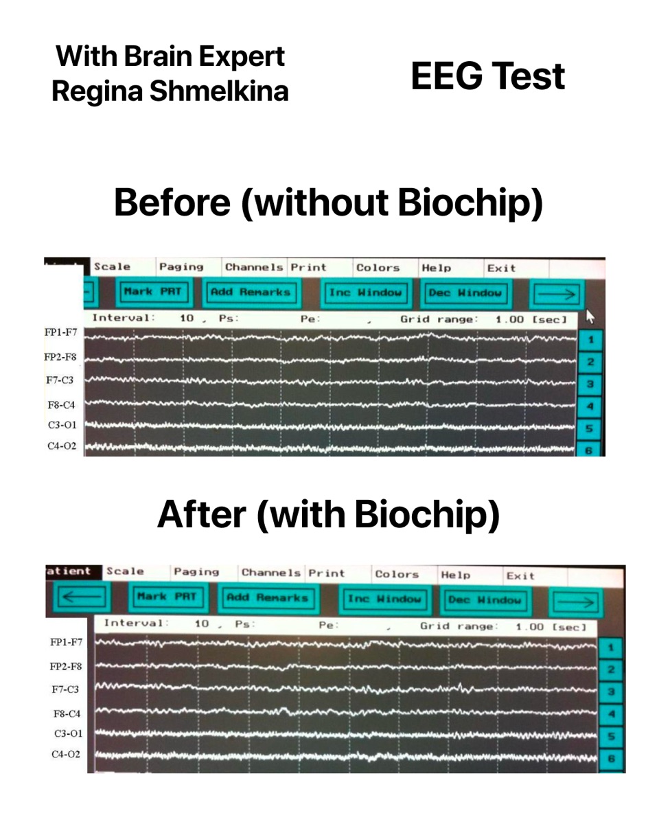 EEG brainwave testing